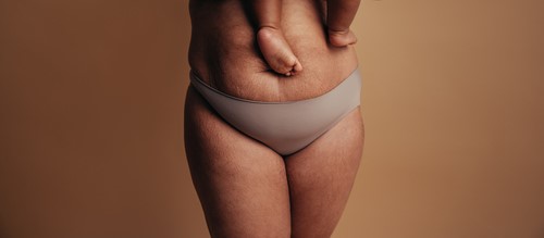 Post Pregnancy Body Shutterstock 1890722134